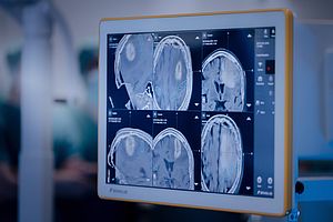 Medizinische Bildgebung unterstützt die Planung moderner Strahlentherapien. Föderierte KI-Ansätze soll dabei neue Möglichkeiten eröffnen.