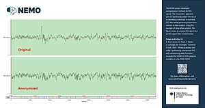 Exemplarische Darstellung eines originalen (oben) und anonymisierten (unten) EEG-Signals aus einer Veröffentlichung im Rahmen des Projekts »NEMO«.