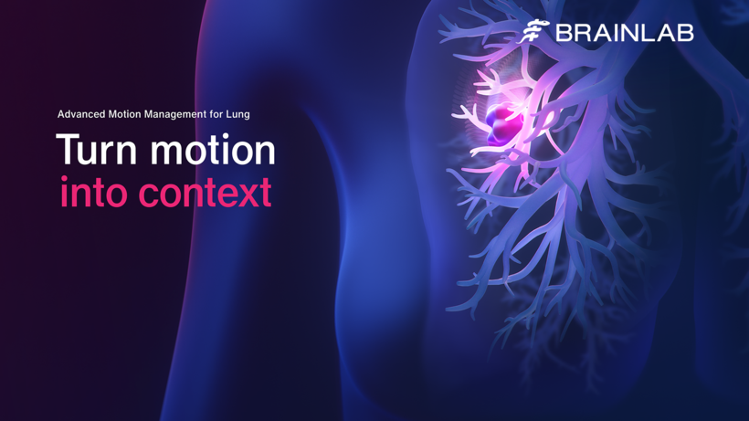 Darstellung einer Lunge via Software-Lösung Advanced Motion Management (AMM) von Brainlab
