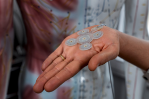 Neuroimplantat EASEE von Precisis