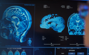 Radiologie-Bilder eines menschlichen Gehirns